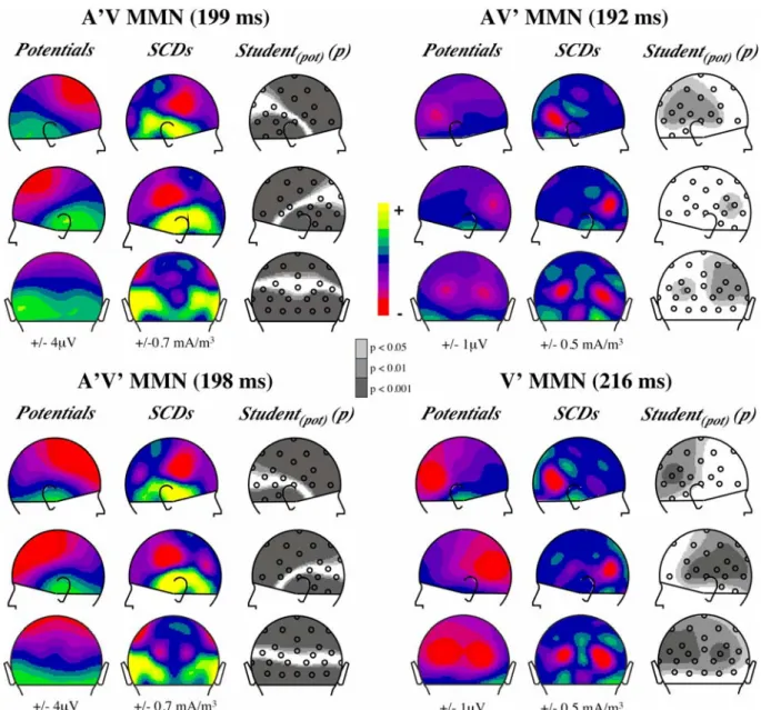 Fig. 3.  Topographies of the MMNs elicited by each deviant type in the audiovisual oddball paradigm and by  the visual deviant in the visual oddball paradigm (lower right panel)