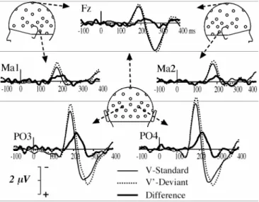 Fig. 5.  ERPs elicited by V standards and V’ deviants and deviant minus standard difference waveforms at a  subset of 5 electrodes (Fz, Ma1, Ma2, PO3 and PO4) from 100 ms pre-stimulus to 400 ms post-stimulus