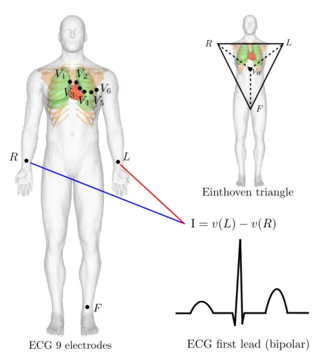 Figure 1.8: Standard 12-lead ECG electrodes position, Einthoven triangle and ﬁrst lead deﬁnition.