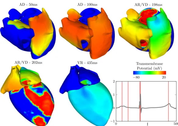 Figure 2.5: Simulations of heart depolarization in a healthy case with the corre- corre-sponding electrocardiogram ﬁrst lead.