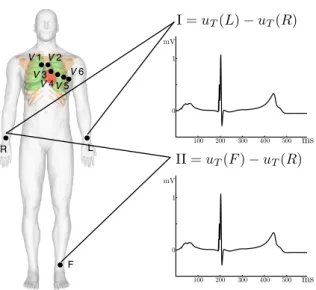 Figure 2.7: Standard 9 electrodes locations and ﬁrst and second ECG leads.