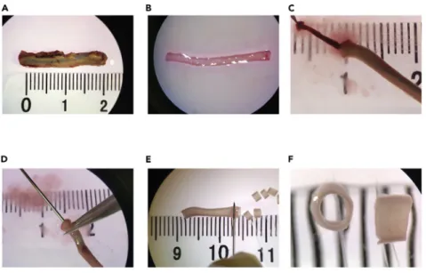 Figure 2. Preparation of aortic rings