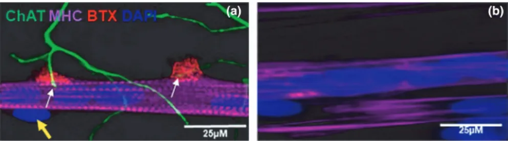 FIGURE 1  Image of neuromuscular junctions (NMJ) in the co- culture of immortalized human skeletal muscle cells with rat- embryo spinal-  cord explants (a) and aneurally cultured immortalized human skeletal muscle cells (b) at day 7