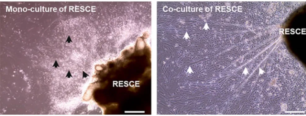 FIGURE 2  A representative image of mono-  and co- culture of RESCE at 72 h. Left panel: shows the deterioration of the mono- culture of  rat- embryo spinal- cord explants with small and short axons indicated by the black arrows