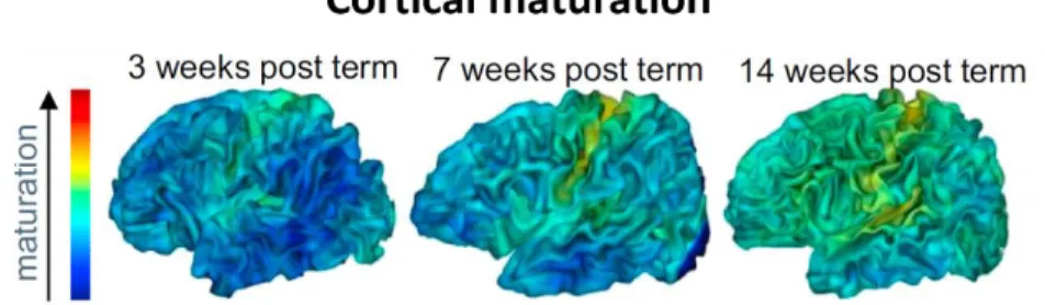 Figure 1.3. Structural imaging of cortical maturation. Asynchronous maturation of cortical regions between 3 and 14 weeks of age  (Adapted from Leroy et al., 2011)
