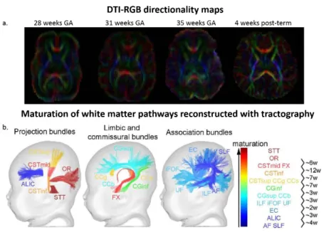 Figure 1. 4. Diffusion MRI of the developing white matter. a) DTI-RGB directionality maps of developing brain