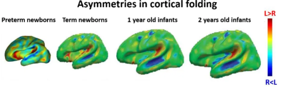 Figure 1.6. Structural imaging of asymmetrical cortical folding. Asymmetries in cortical folding in preterm and post-term periods  (Adapted from Dubois &amp; Dehaene-Lambertz., 2015)