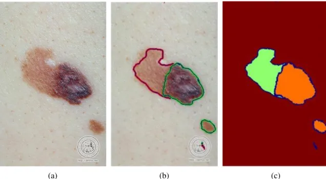 Figure 4.12: Implementation of the approach using equation (4.13). (a): Original RGB image