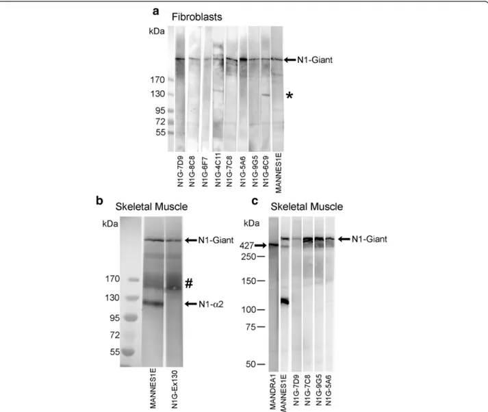 Fig. 3 Western blots with nesprin-1 mAbs. Extracts of a cultured human dermal fibroblasts probed with the new mAbs against exons 81 to 86 of nesprin-1-giant and b normal adult human skeletal muscle probed with the new mAb N1G-Ex130 against exon 130 of nesp