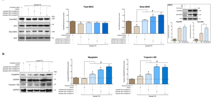 Figure 6.  Obestatin signaling regulates HDAC phosphorylation related to slow fiber expression in skeletal  muscle