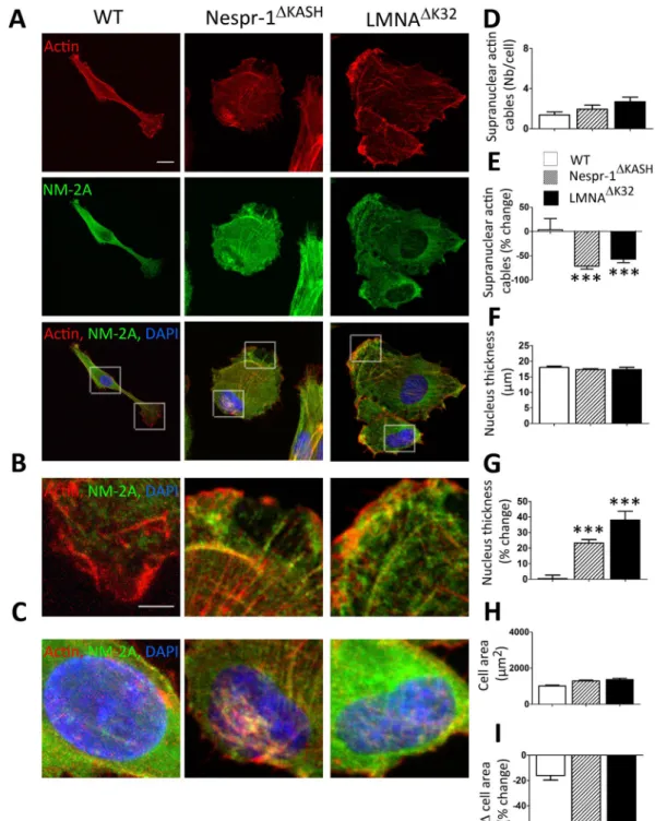 Figure 6.  siRNA against FHOD1 reduced actin contractility and nucleus thickness in myoblasts on soft  matrix (12 kPa)