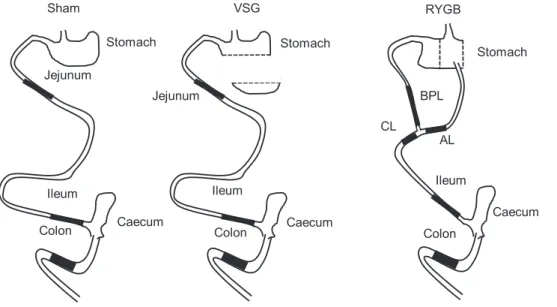 Fig. 1. Schematic representations of normal (Sham) and remodeled gastrointestinal tract after VSG and RYGB procedures