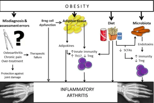 Figure 1 Potential mechanisms explaining the link between obesity and inflammatory arthritis
