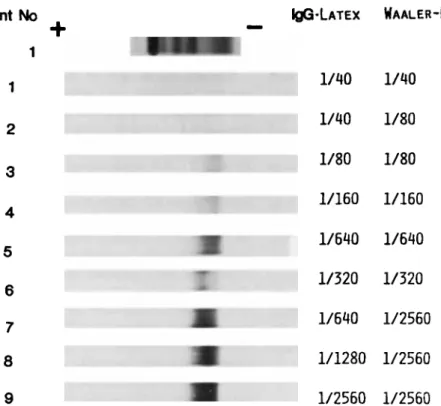 Fig. 2.  Comparative study of monoclonal IgM and IgA with and without  known anti-IgG  antibody  activity