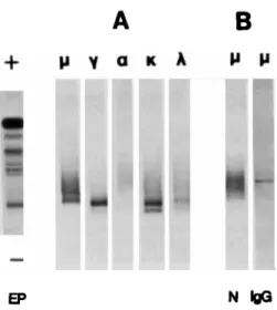 Fig.  3.  Electrophoresis (EP), standard Western blots ( A )   and FAT  (B, N,  normal  uncoated nitrocelllose; IgG,  polyclonal  IgG-coated  nitrocellulose)  of a CLL serum containing oligoclonal Ig (IgMX, IgMh,  IgGK,  1gGX) with-  out RF activity by  FA