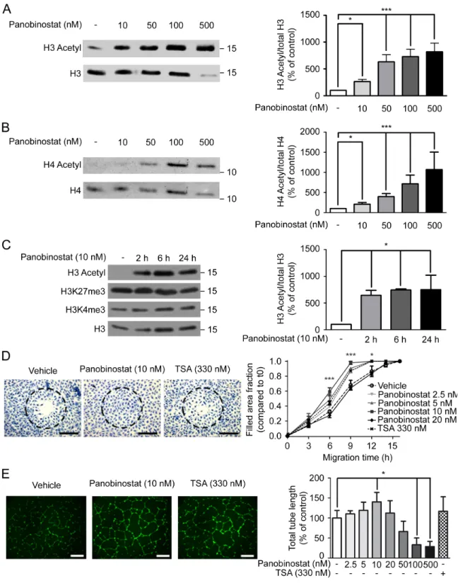 Figure  S2  (related  to  Figure  1):  Pharmacologic  treatment  with  the  HDAC  inhibitor  panobinostat  increases ECFCs migration and capillary-network formation