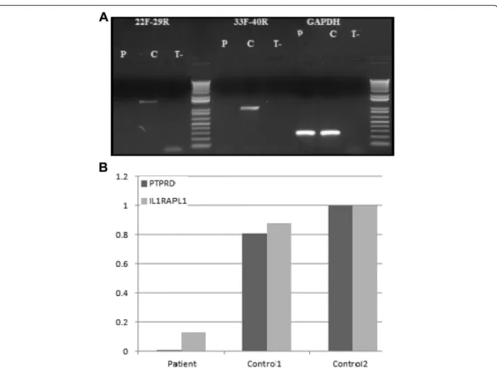Fig. 4 RT-PCR amplifications along the PTPRD gene and expression of IL1RAPL1 in fibroblasts using Q-PCR