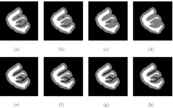 Figure .3: First row (a) - (d): Different initial configurations of a synthetic phantom.