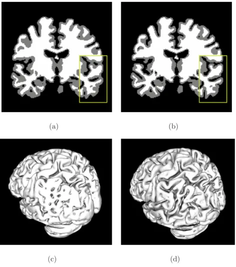 Figure .4: (a) Initial and (b) topologically corrected WM-GM segmentations, highlighted within the rectangle; (c) marching cubes reconstruction of GM before and (d) after the topology correction procedure.