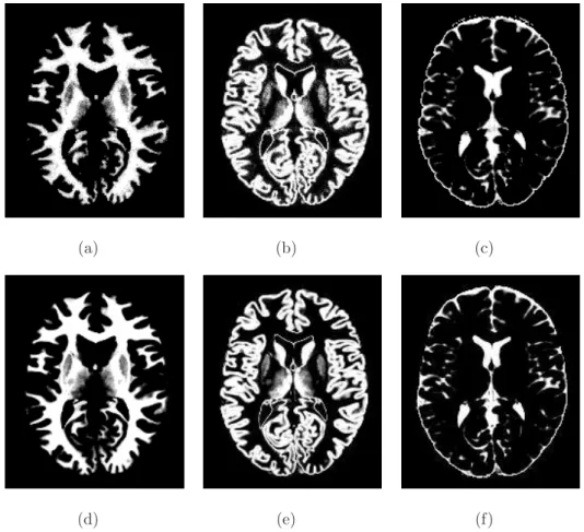 Figure .8: Partial volume segmentation of a simulated BrainWeb volume (3% noise, 20%