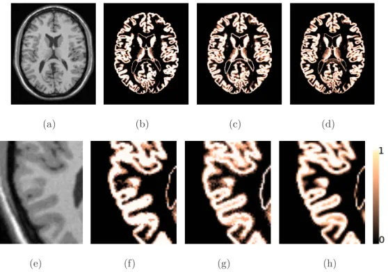 Figure .9: Example of PV estimation of a simulated BrainWeb volume (3% noise, 20% bias field)