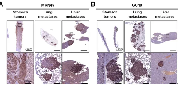Figure  2.  Detection  of  gastric  tumors  and  distant  micrometastases  and  macrometastases  by  immunohistochemistry  in  orthotopic  xenograft  mice