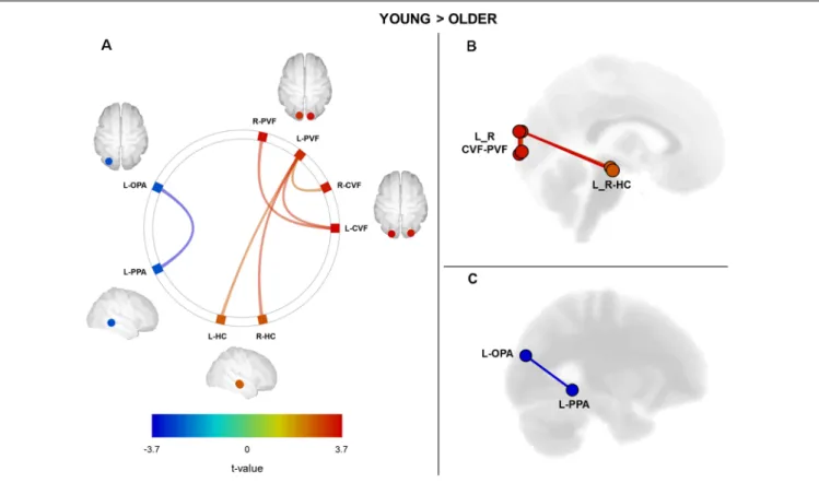 FIGURE 1 | Cerebral regions (ROI-to-ROI analysis) showing a significant difference between groups (Young Group vs
