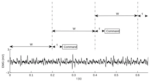 Figure 3.3: EMG signal with 200 ms adjacent epochs. The signal was sampled at 10 kHz which is the rate the signal processing unit must work (10 thousand values per second).