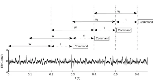 Figure 3.4: EMG signal with 200 ms overlapping epochs and 100 ms increment time (50% overlap)