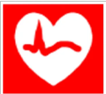 FIGURE 1 | Example of VCM icon to describe a cardiac rhythm disorder.