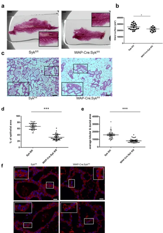 Figure 8. Syk expression loss negatively affects epithelial morphogenesis and E-cadherin localization  at cell-cell junctions in lactating mammary glands