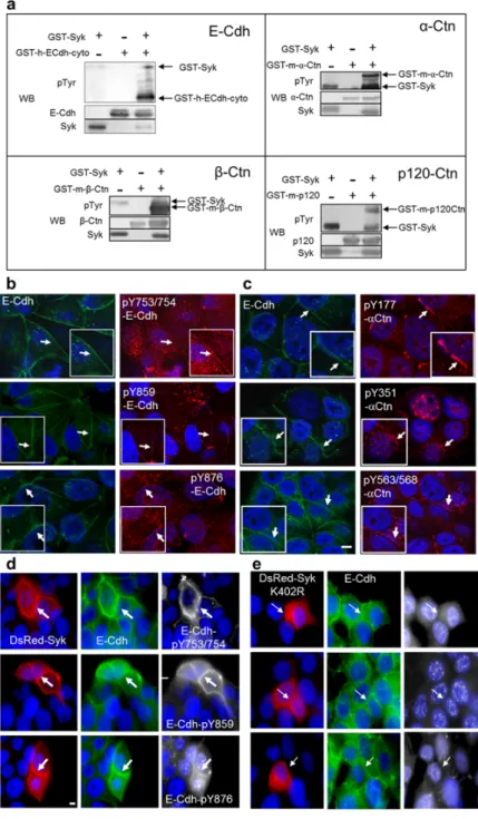 Figure 1. Spleen tyrosine kinase (Syk) phosphorylates E-cadherin and α-,  β-, and p120-catenins and their  phosphorylated forms localize at adherens junctions