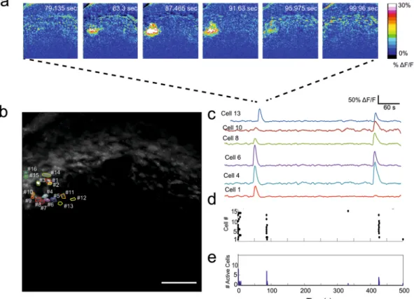 Figure 3.  Localised synchronous activity starts in the vicinity of blood vessels. (a) Representative time-lapse of  Δ F/F images displaying localised synchronous activity