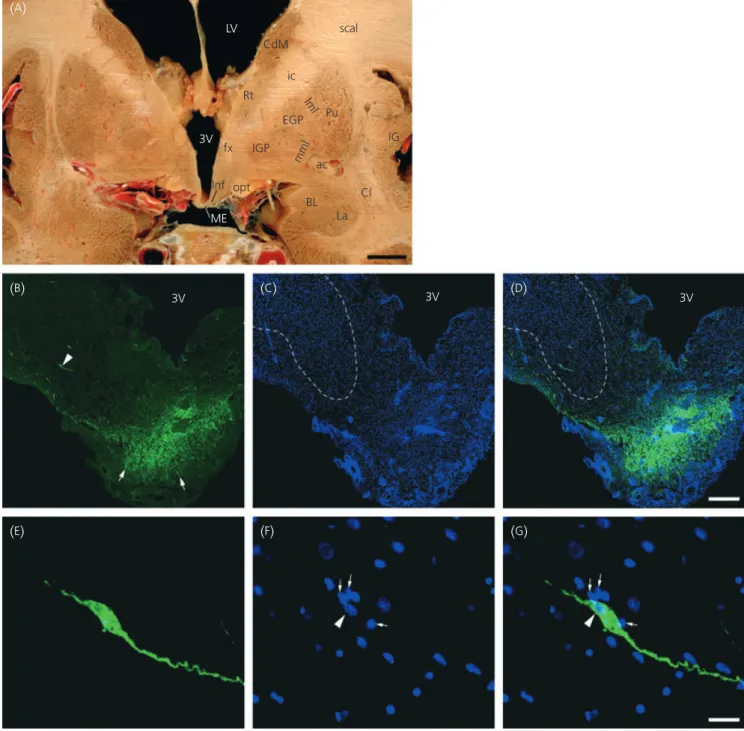 Fig. 1. Localisation of gonadotrophin-releasing hormone (GnRH) immunoreactivity by fluorescent microscopy in the tuberal region of the human hypothala- hypothala-mus