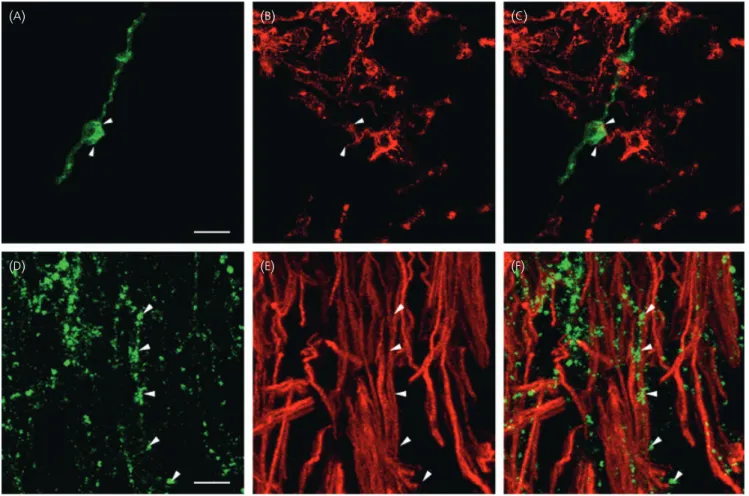 Fig. 3. Anatomical relationship between gonadotrophin-releasing hormone (GnRH)-immunoreactive neurones and vimentin-immunoreactive astrocytes and tanycytes in the tuberal region of the human hypothalamus