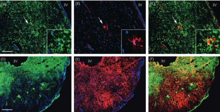 Fig. 4. Distribution of glial fibrillary acidic protein (GFAP) and vimentin immunoreactivities in the tuberal region of the human hypothalamus