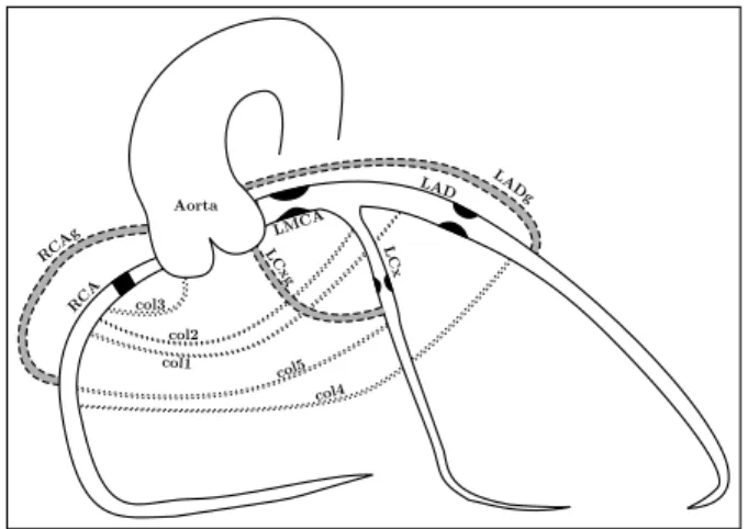 Fig. 2. Electrical representation of the coronary circulation model. Grafts are represented with dashed lines, collaterals with dotted lines.