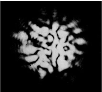 Figure 1.1 – Image focale simul´ee d’une ´etoile ponctuelle obtenue avec un t´elescope de 2m de diam`etre ( c  Labeyrie [20]).