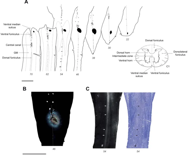 Figure 1. Fluorescent micrograph of E117 injection site. (A) Horizontal sections of the upper spinal cord with the uptake zone of the Fast Blue injection site indicated in black; (B) Fluorescent micrograph showing the uptake zone outlined in red in section