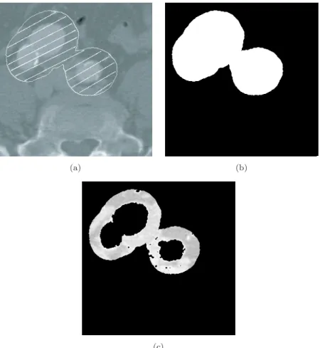 Fig. 8. (a) From the given contour in the ﬁrst cut (Fig. 7(d)), we have obtained the ROI ω 2 ; (b) ﬁlling in the ROI ω 2 to estimate the image model; (c) result of the robust local estimation of the aorta in the second cut.