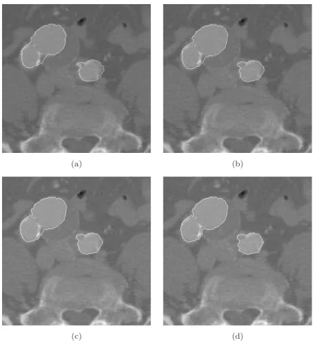 Fig. 9. Segmentation process related to the second image of the sub-sequence, (a) initialization with the contour obtained on the ﬁrst cut (image), (Fig