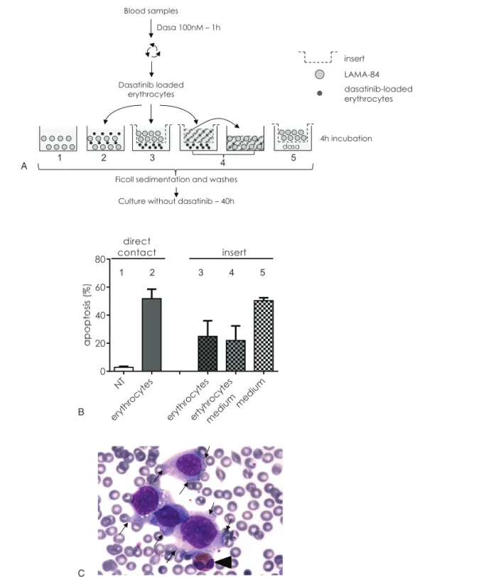 Figure 4. Dasatinib-loaded erythrocytes induce apoptosis of leukemic cells through a contact-dependent mechanism