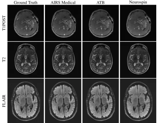 Figure 2 shows example images for radiologist evaluation from the 8X track with Siemens data