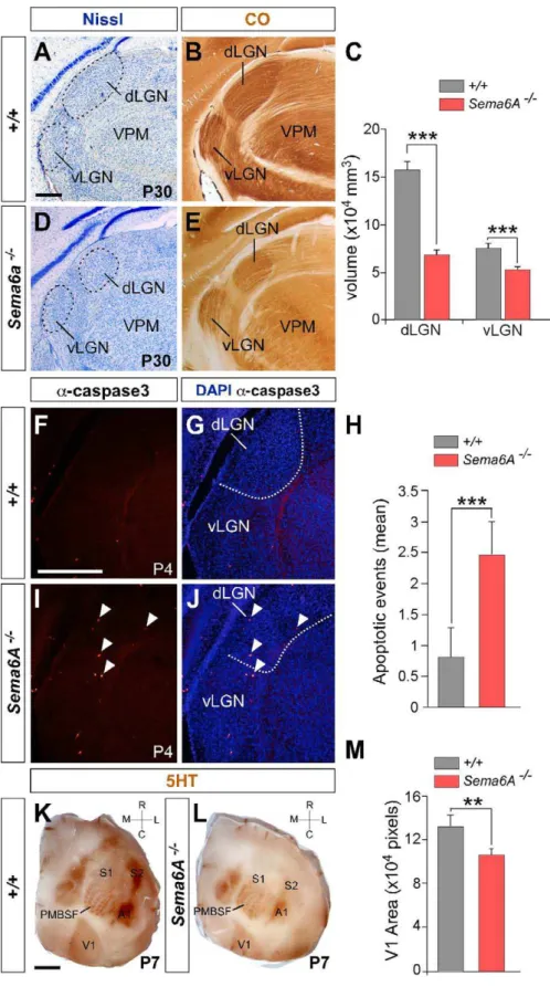 Figure 9. Effects of Loss of Sema6A on the Structure and Extension of Both dLGN and the Visual Cortex