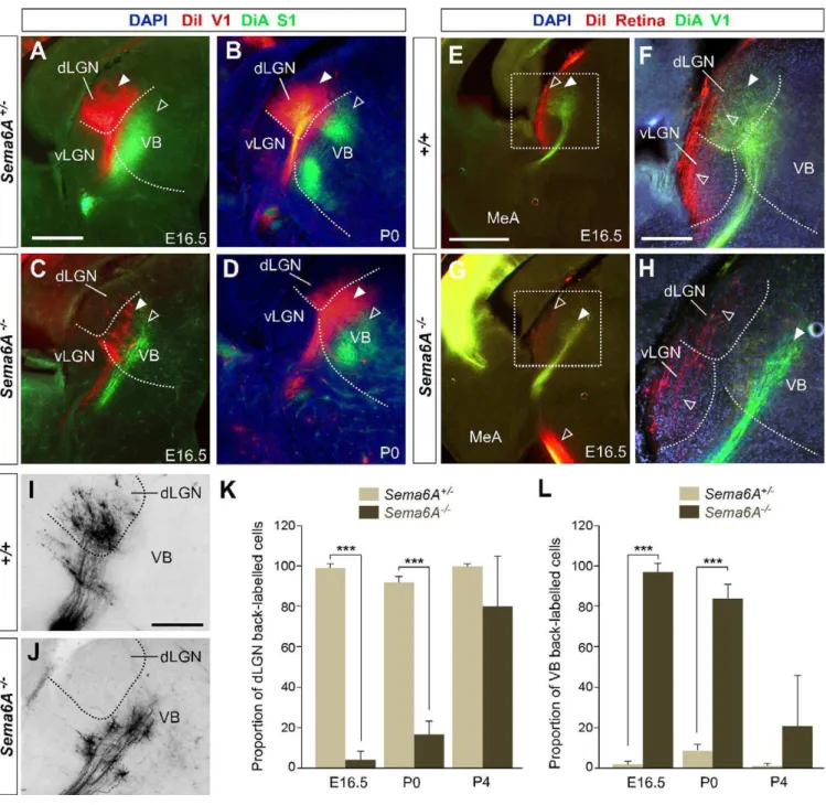 Figure 5. Early Topographical Defects in Thalamocortical Connectivity in Sema6A / Mice (A–J) Coronal sections showing back-labeling in dorsal thalamus.