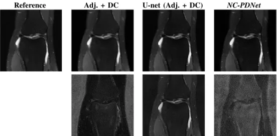 Fig. 7. 2D multi-coil spiral acquisition (reverse setting, knee dataset): Reconstruction results for a specific slice (16th slice of file1000000, part of the validation set) with networks trained on radial trajectories