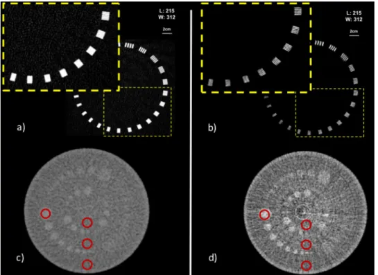 Figure 3.  Images acquired on the Catphan 504 phantom. MTF module on the top (a and b) and low contrast  module on the bottom (c and d) (a and c) are acquired at the hospital with the inner ear protocol (CTDI  183mGy)