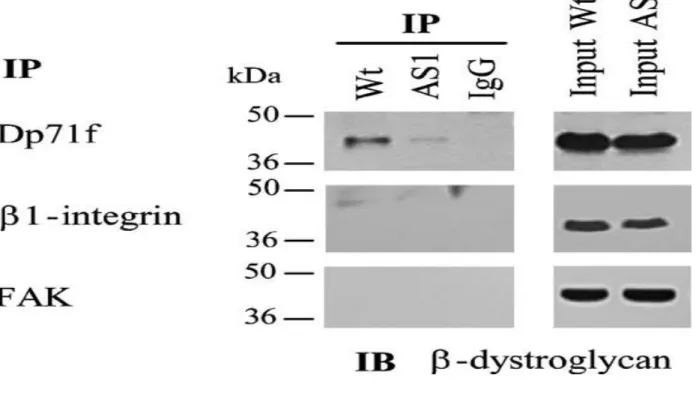 Figure 6.  β-Dystroglycan interacts with  Dp71f but  not with β1 integrin or  FAK. Lysates  from  wild-type  and  antisense-Dp71  cell  cultures,  grown  on  laminin-coated  plates,  were  immunoprecipitated  with  anti-Dp71f  (5F3),  anti-β1  integrin  or