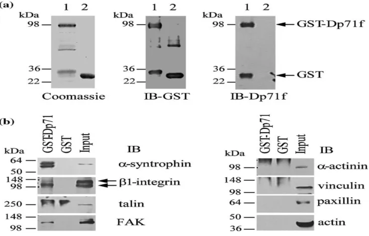 Figure 7. In vitro interaction of Dp71f with β1 integrin and FAK. GST and GST-Dp71f proteins,  isolated  by  incubation  of  JM109  bacterial  lysates  with  glutathione-Sepharose  beads,  were  analyzed by SDS-PAGE followed by staining with Coomassie bril