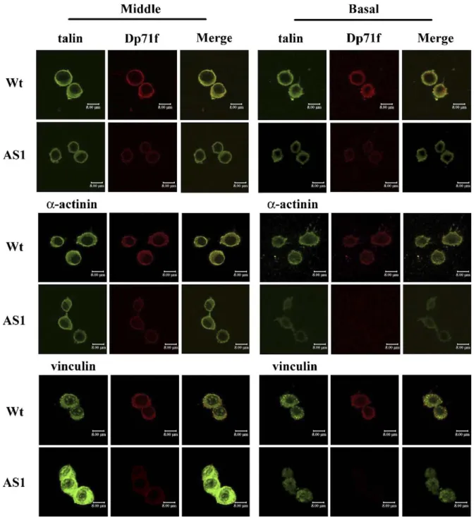 Figure  2.  Subcellular  distribution  of  Dp71f  and  the  adhesion-associated  proteins  in  the  wild- wild-type  and  antisense-Dp71  PC12  cells